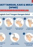 Penyakit Tangan Kaki dan Mulut (HFMD) - Pencegahan Dan Kawalan